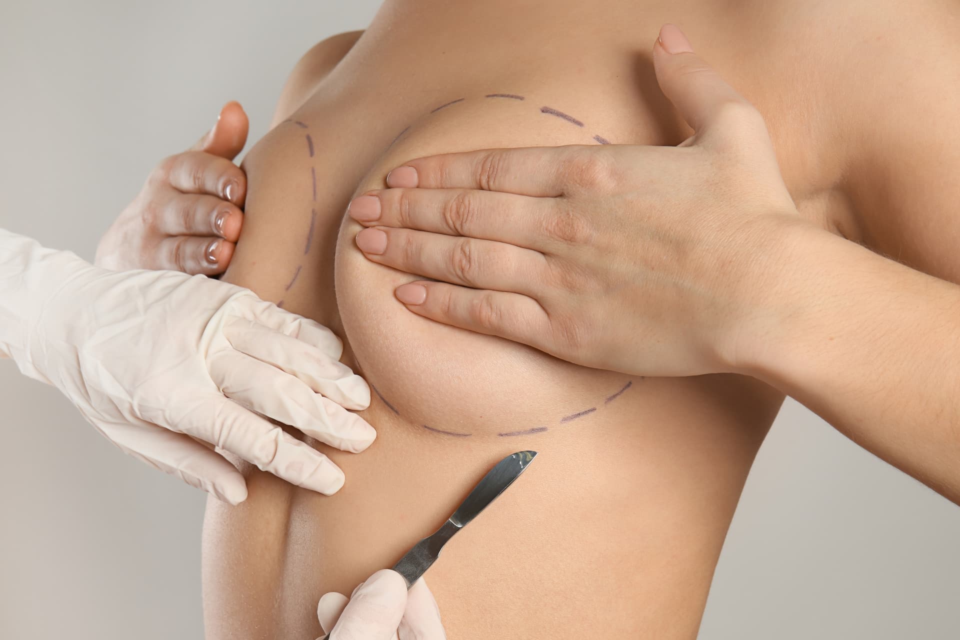 Breast Surgery at LHCSC London