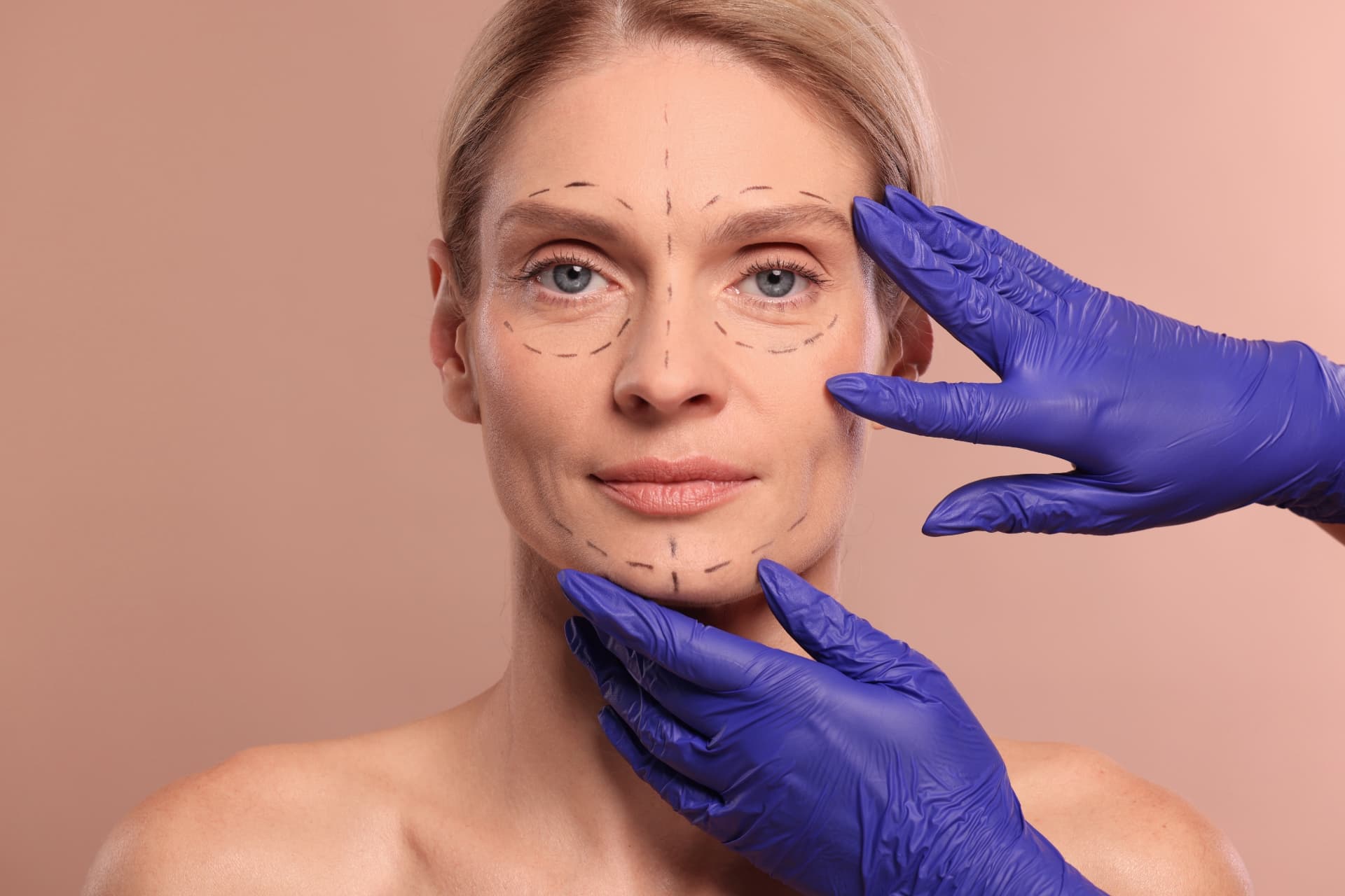 Double Chin & Neck Liposuction consultation at LHCSC London, London