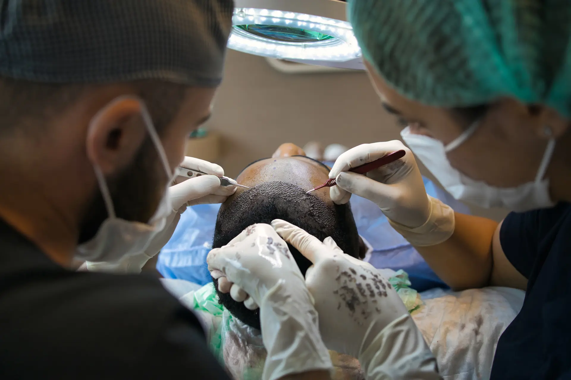 FUE hair transplant procedure being performed at LHCSC London