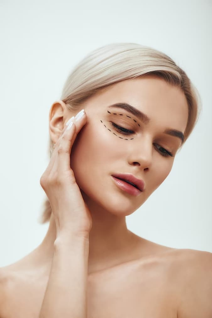 Blepharoplasty (Eyelid Surgery) results at LHCSC London, London