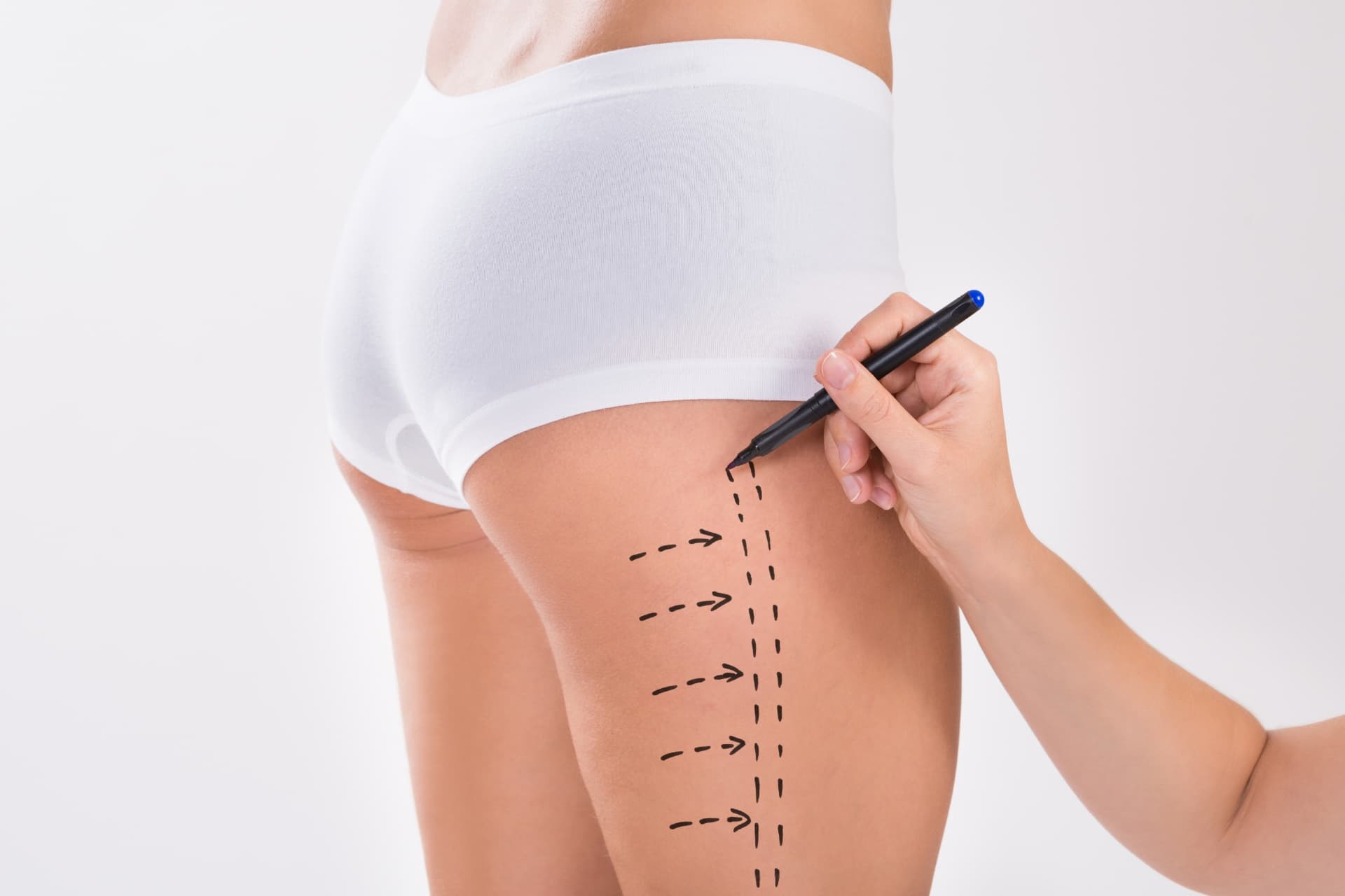 Thigh Liposuction at LHCSC London, London
