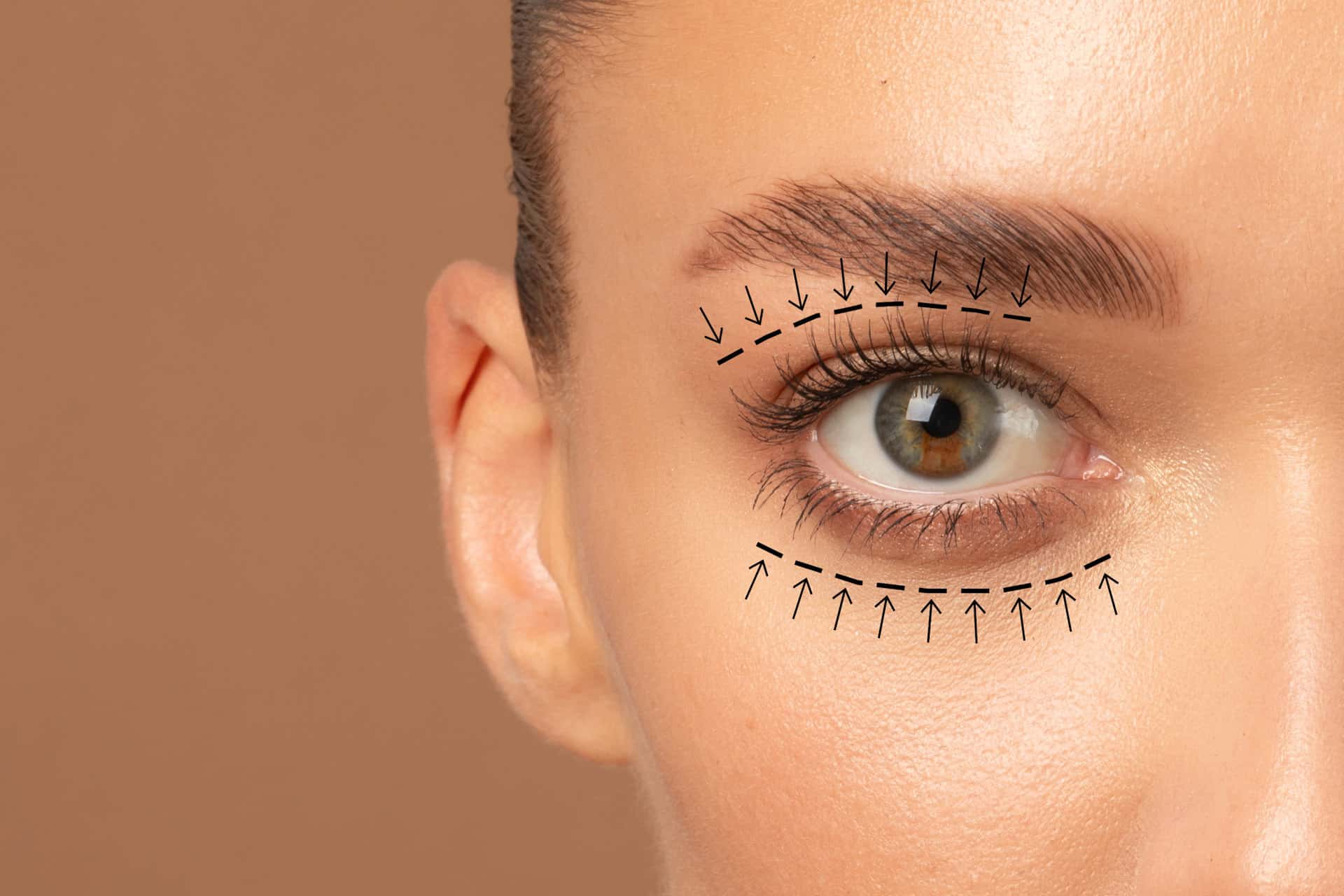Blepharoplasty (Eyelid Surgery) at LHCSC London, London