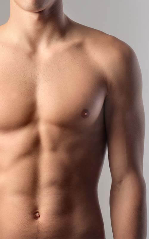 Male Breast Liposuction (Gynaecomastia) results at LHCSC London, London