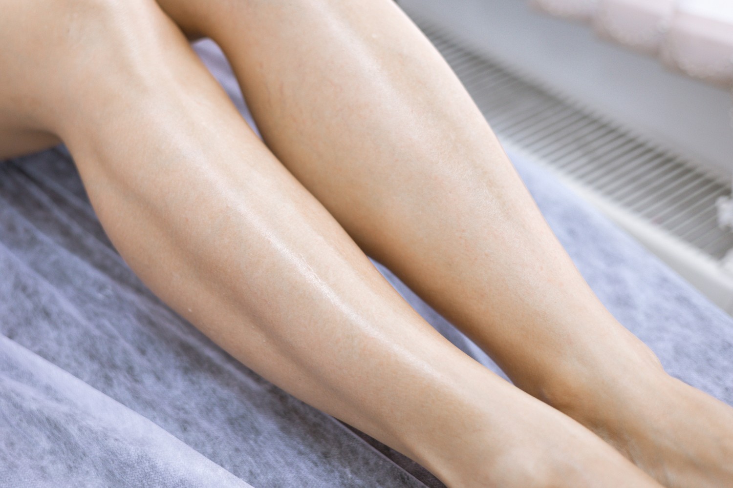 Foamsclerotherapy